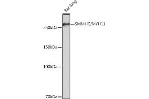 Western blot analysis of extracts of Rat lung, using SMMHC/SMMHC/MYH11 Rabbit mAb (ABIN7268745) at 1:1000 dilution. (MYH11 antibody)
