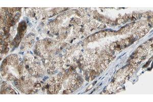 ABIN6272607 at 1/100 staining Human prostate tissue by IHC-P. (PIK3C2G antibody  (C-Term))