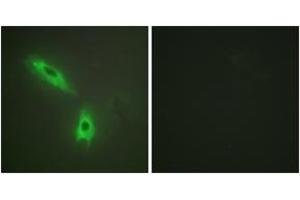 Immunofluorescence analysis of HeLa cells, using TNFC Antibody. (LTB antibody  (AA 181-230))