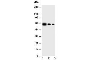 Western blot testing of IL23 p19 antibody and Lane 1:  recombinant mouse protein 10ng (IL23A antibody  (N-Term))
