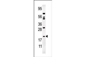 Western blot analysis of anti-AK1 Pab (ABIN392794 and ABIN2842231) in Jurkat cell line lysate (35 μg/lane). (Adenylate Kinase 1 antibody  (N-Term))