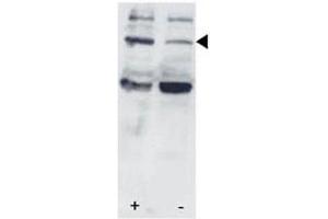 Western blot testing of p-STAT3 antibody and HL-60 cells/lysate collected before (-) or after (+) stimulation with IFN-a.