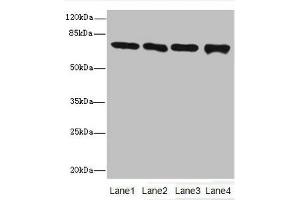Western blot All lanes: Protein-arginine deiminase type-2 antibody at 16 μg/mL Lane 1: PC-3 whole cell lysate Lane 2: Hela whole cell lysate Lane 3: Mouse brain tissue Lane 4: MDA-MB-231 whole cell lysate Secondary Goat polyclonal to rabbit IgG at 1/10000 dilution Predicted band size: 76, 50 kDa Observed band size: 76 kDa (PADI2 antibody  (AA 1-665))