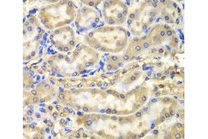 Immunohistochemistry of paraffin-embedded Mouse kidney using Myelin Basic protein Polyclonal Antibody at dilution of 1:200 (40x lens). (MBP antibody)