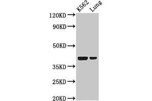 Western Blot Positive WB detected in: K562 whole cell lysate, Rat lung tissue All lanes: PTX3 antibody at 2 μg/mL Secondary Goat polyclonal to rabbit IgG at 1/50000 dilution Predicted band size: 42 kDa Observed band size: 42 kDa (PTX3 antibody  (AA 99-164))