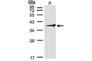 WB Image Sample(30 μg of whole cell lysate) A:MOLT4, 12% SDS PAGE antibody diluted at 1:500 (RNF2 antibody  (C-Term))