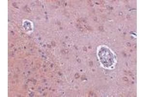 Immunohistochemistry (IHC) image for anti-Family with Sequence Similarity 120A (FAM120A) (Middle Region) antibody (ABIN1030930) (FAM120A antibody  (Middle Region))