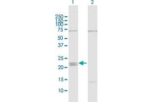 Western Blot analysis of IFNE1 expression in transfected 293T cell line by IFNE1 MaxPab polyclonal antibody. (IFNE antibody  (AA 1-208))