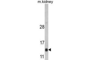 Western Blotting (WB) image for anti-DnaJ (Hsp40) Homolog, Subfamily C, Member 19 (DNAJC19) antibody (ABIN3002676)