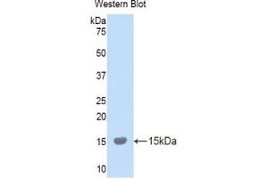 Western Blotting (WB) image for anti-Lysyl Oxidase-Like 2 (LOXL2) (AA 323-427) antibody (ABIN2938096)