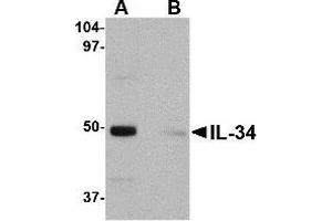 Western blot analysis of IL-34 in human brain tissue lysate with IL-34 antibody at 0. (IL-34 antibody  (Center))