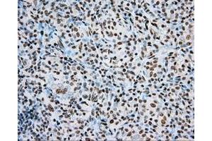 Immunohistochemical staining of paraffin-embedded Kidney tissue using anti-ARNT mouse monoclonal antibody. (ARNT antibody)