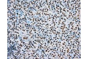 Immunohistochemical staining of paraffin-embedded Kidney tissue using anti-ARNT mouse monoclonal antibody.