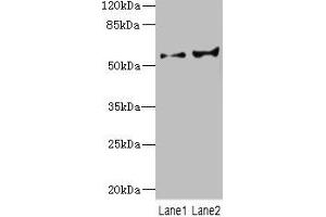 Western blot All lanes: CYP2C18 antibody at 5. (CYP2C18 antibody  (AA 231-490))