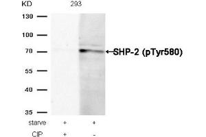 Western blot analysis of extracts from 293 cells, treated with starve or calf intestinal phosphatase (CIP), using SHP-2 (Phospho-Tyr580) Antibody. (PTPN11 antibody  (pTyr580))