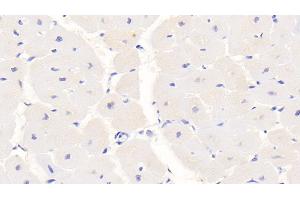 Detection of S100 in Human Cardiac Muscle Tissue using Monoclonal Antibody to S100 Calcium Binding Protein (S100)