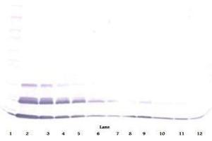 Image no. 2 for anti-Chemokine (C-C Motif) Ligand 15 (CCL15) antibody (Biotin) (ABIN465724) (CCL15 antibody  (Biotin))