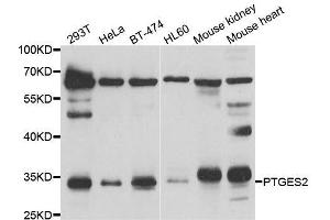 Western blot analysis of extracts of various cell lines, using PTGES2 antibody. (PTGES2 antibody  (AA 88-377))