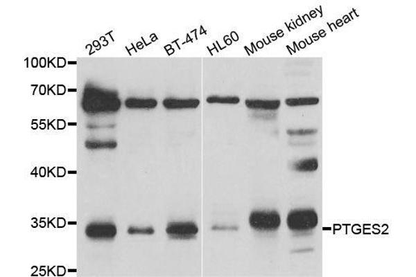 PTGES2 抗体  (AA 88-377)