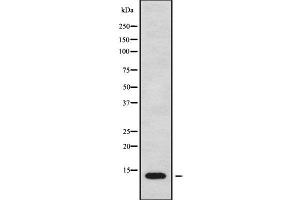 Western blot analysis of MT-ND4L using MCF7 whole cell lysates (MT-ND4L antibody)