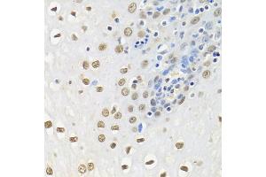 Immunohistochemistry of paraffin-embedded human esophagus using ELAVL1 antibody (ABIN6292898) at dilution of 1:100 (40x lens).