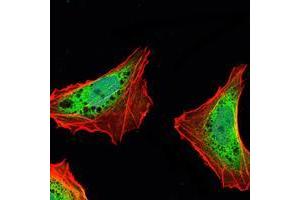 Immunofluorescence (IF) image for anti-Ataxin 1 (ATXN1) antibody (ABIN968970)
