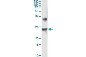 Immunoprecipitation of UBE2T transfected lysate using anti-UBE2T monoclonal antibody and Protein A Magnetic Bead , and immunoblotted with UBE2T MaxPab rabbit polyclonal antibody. (Ube2t antibody  (AA 1-197))