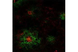 Indirect immunostaining of an PFA fixed section from a 5XFAD mouse with mouse anti-Abeta-pE3, clone 70D7 (dilution 1 : 100; red) and rabbit anti-Abeta (cat. (Abeta-pE3 (AA 3-7) antibody)