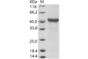 Western Blotting (WB) image for Bundibugyo Ebola Virus Envelope Glycoprotein (BEBOV GP) protein (Fc Tag) (ABIN7198901) (BEBOV GP Protein (Fc Tag))
