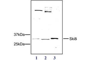 Western Blot of Rabbit anti-SKI8 antibody Western Blot results of Rabbit anti-SKI8 antibody.
