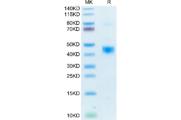 TGFB1 Protein (AA 30-278) (His-Avi Tag,Biotin)