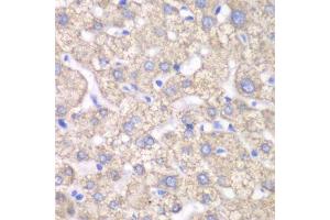 Immunohistochemistry of paraffin-embedded human liver injury using ACAT1 antibody. (ACAT1 antibody  (AA 1-145))