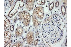 Image no. 1 for anti-Retinoic Acid Receptor Responder (Tazarotene Induced) 1 (RARRES1) antibody (ABIN1500600) (RARRES1 antibody)
