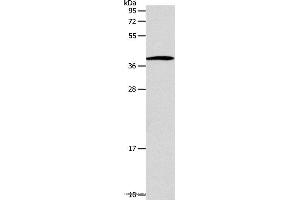 Western blot analysis of Human lymphoma tissue, using SLC25A11 Polyclonal Antibody at dilution of 1:600 (SLC25A11 antibody)