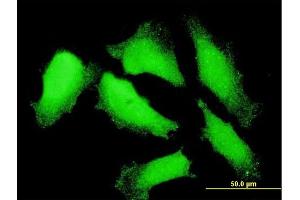 Immunofluorescence of monoclonal antibody to NXT1 on HeLa cell. (NXT1 antibody  (AA 1-140))