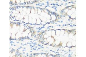 Immunohistochemistry of paraffin-embedded Human colon using NMT1 Polyclonal Antibody at dilution of 1:100 (40x lens). (NMT1 antibody)