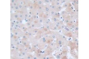IHC-P analysis of Human Tissue, with DAB staining. (SERPINC1 antibody  (AA 33-464))