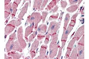 Human Heart (formalin-fixed, paraffin-embedded) stained with APAF1at 10 µg/ml followed by biotinylated goat anti-rabbit IgG secondary antibody, alkaline phosphatase-streptavidin and chromogen. (APAF1 antibody  (C-Term))