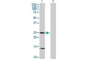 Western Blot analysis of ARHGDIA expression in transfected 293T cell line by ARHGDIA MaxPab polyclonal antibody. (ARHGDIA antibody  (AA 1-204))