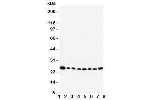 Western blot testing of Rab8 antibody and Lane 1:  rat brain (RAB8A antibody  (C-Term))