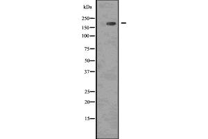 Western blot analysis of Phospho-EGFR ( Tyr1068 ) using COLO205 whole cell lysates (EGFR antibody  (pTyr1092))