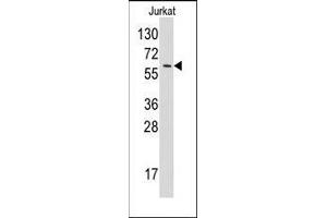 Western blot analysis of anti-YARS Pab in Jurkat cell line lysates (35ug/lane).