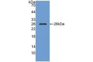 Detection of Recombinant PGA, Human using Monoclonal Antibody to Pepsinogen A (PGA) (Pepsinogen A antibody  (AA 63-295))