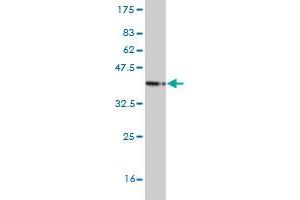 Western Blot detection against Immunogen (36. (MSH5 antibody  (AA 736-835))