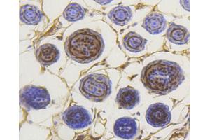 Paraformaldehyde-fixed, paraffin embedded mouse skin section, Antigen retrieval by boiling in sodium citrate buffer (pH6) for 15min, Block endogenous peroxidase by 3% hydrogen peroxide for 30 minutes, Blocking buffer at 37°C for 20min, Antibody incubation with Smad3(S423/S425) (5C5 ) Monoclonal Antibody  at 1:50 overnight at 4°C, followed by a conjugated secondary and DAB staining. (SMAD3 antibody  (pSer423, pSer425))