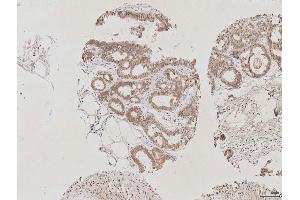 Immunohistochemistry (IHC) image for anti-Aquaporin 2 (Collecting Duct) (AQP2) (AA 171-271) antibody (ABIN707576)