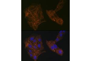 Immunofluorescence (IF) image for anti-Actinin, alpha 4 (ACTN4) antibody (ABIN7265399)