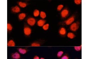 Immunofluorescence analysis of Hela cells using CHAMP1 Polyclonal Antibody at dilution of 1:100 (40x lens). (ZNF828 antibody)