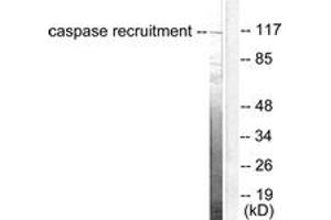 Western blot analysis of extracts from HeLa cells, using CARD6 Antibody. (CARD6 antibody  (AA 1-50))