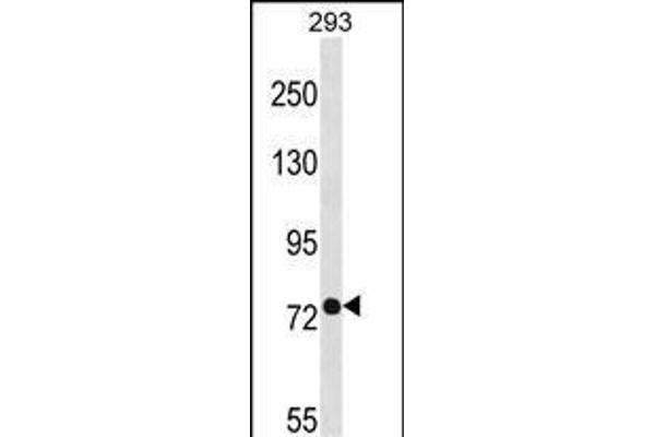 PHEX antibody  (C-Term)